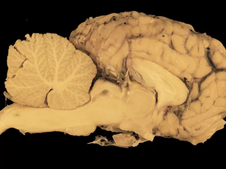 anatomia para el movimiento