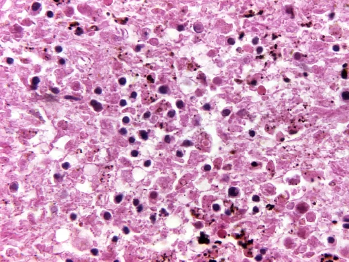 las noches de la peste